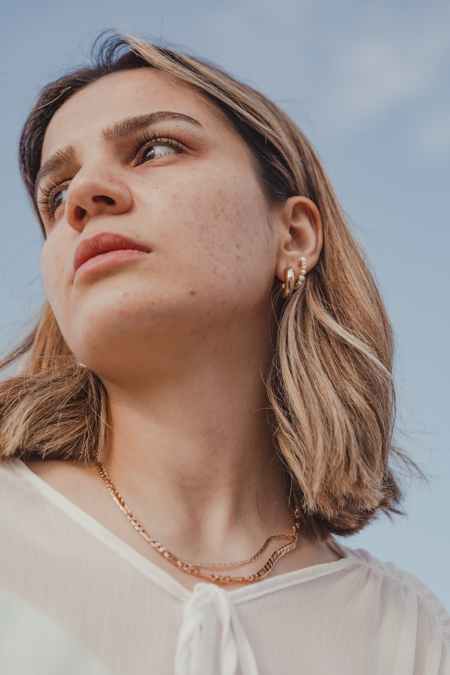 Portrait of a Woman with Acne Scars